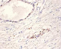 Immunohistochemistry of paraffin-embedded human prostate tissue using CSB-PA09929A0Rb at dilution of 1:100