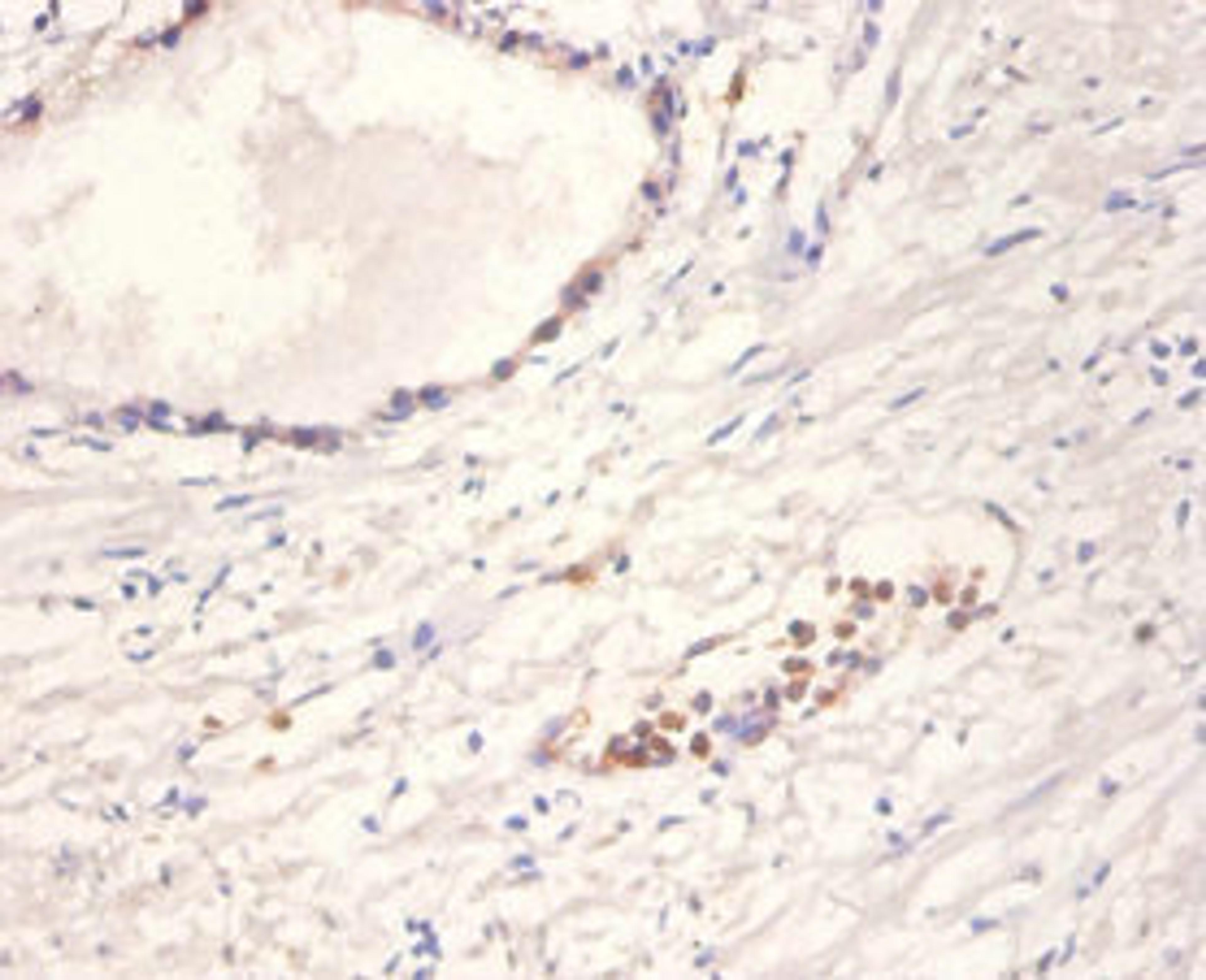 Immunohistochemistry of paraffin-embedded human prostate tissue using CSB-PA09929A0Rb at dilution of 1:100