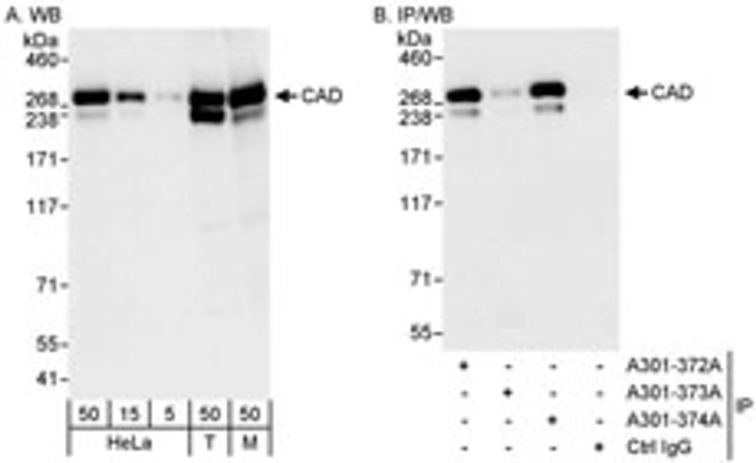 Detection of human and mouse CAD by western blot (h&m) and immunoprecipitation (h).