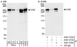 Detection of human and mouse CAD by western blot (h&m) and immunoprecipitation (h).