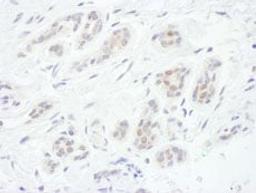 Detection of human FOXC1 by immunohistochemistry.