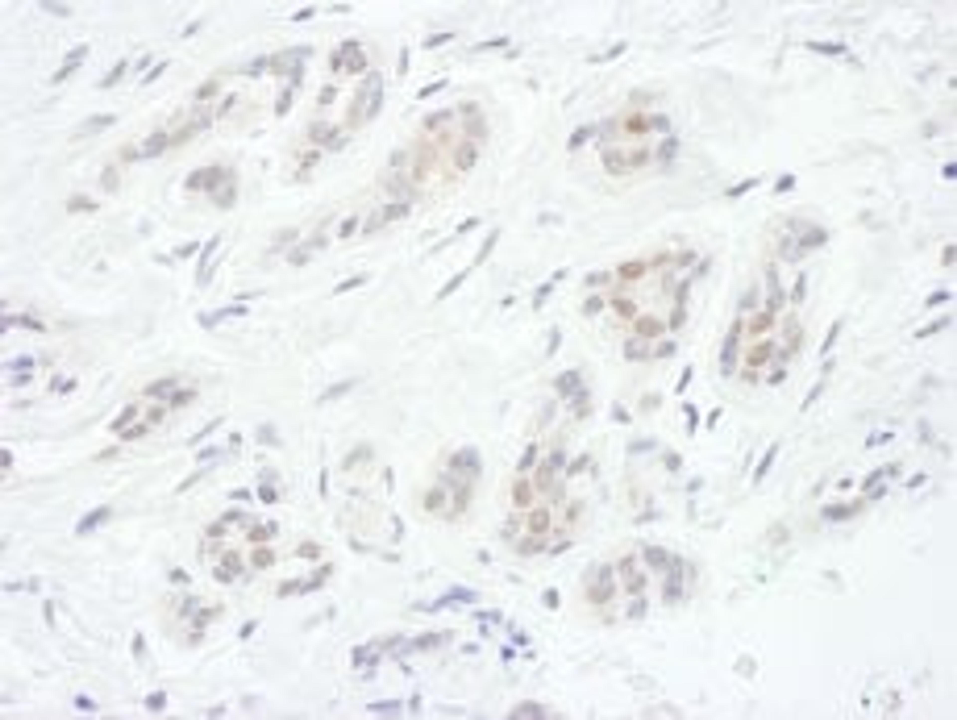 Detection of human FOXC1 by immunohistochemistry.