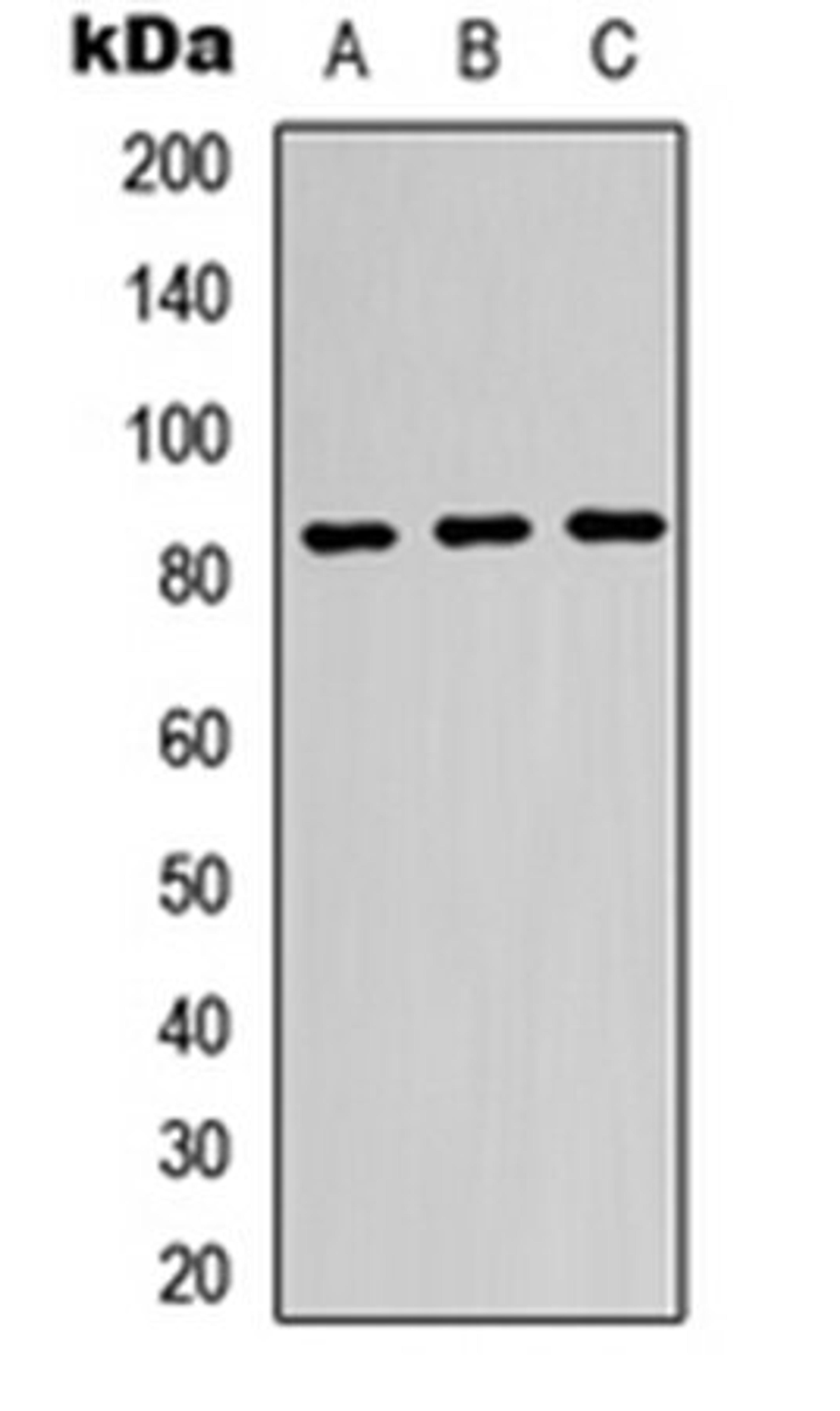 Western blot analysis of K562 (Lane1), HeLa (Lane2), HepG2 (Lane3) whole cell using beta-glucuronidase antibody