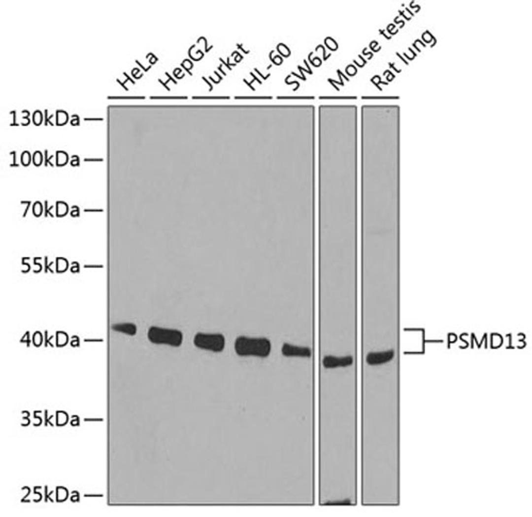 Western blot - PSMD13 antibody (A6956)