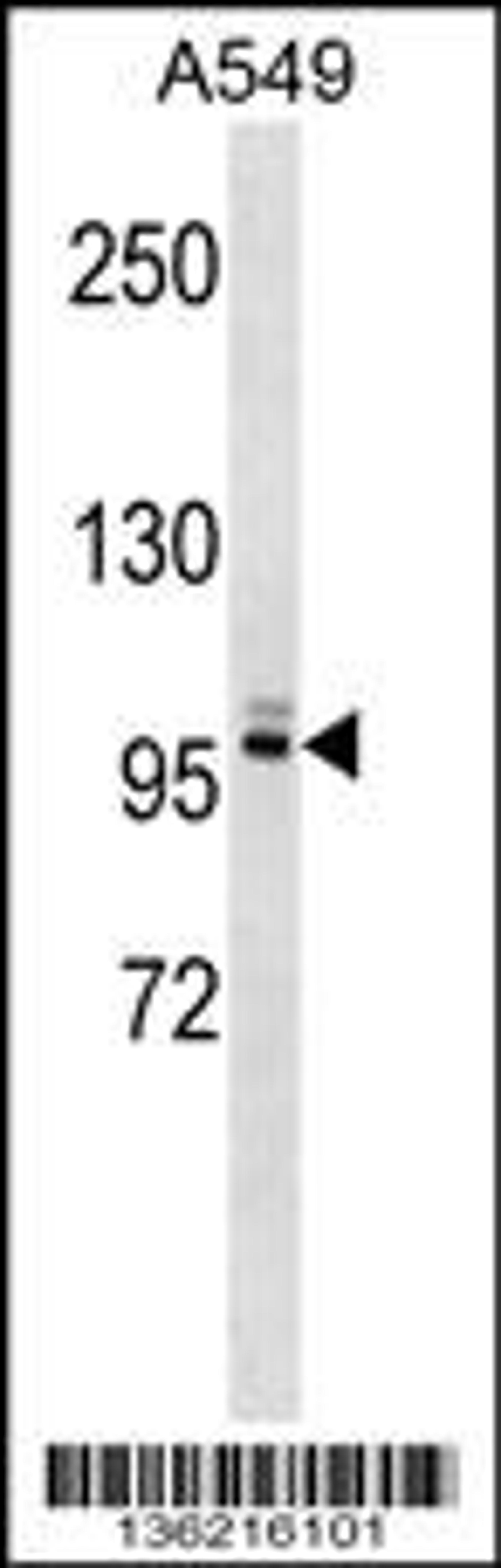 Western blot analysis in A549 cell line lysates (35ug/lane).