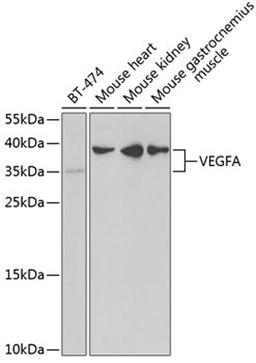 Western blot - VEGFA antibody (A5708)