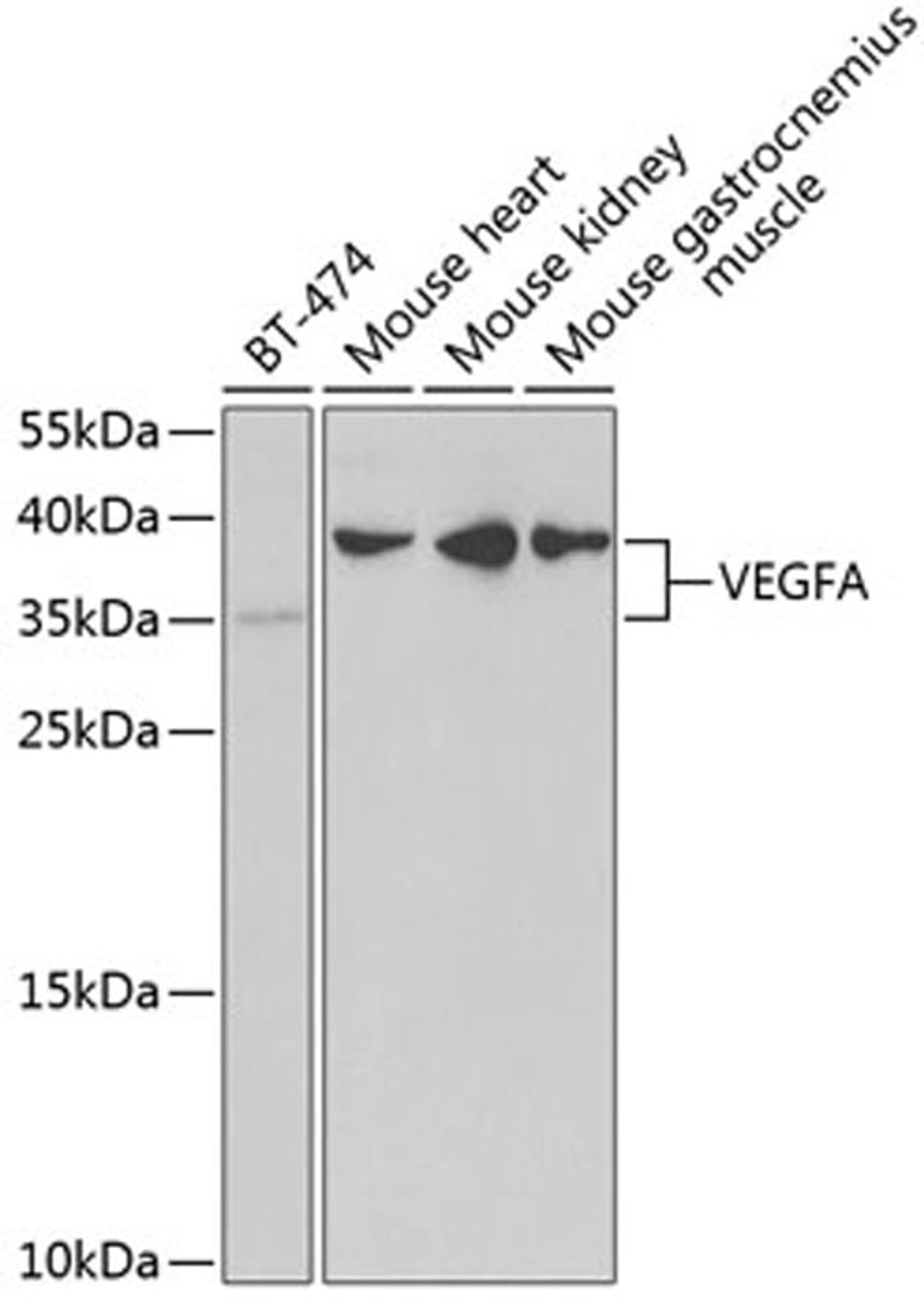 Western blot - VEGFA antibody (A5708)