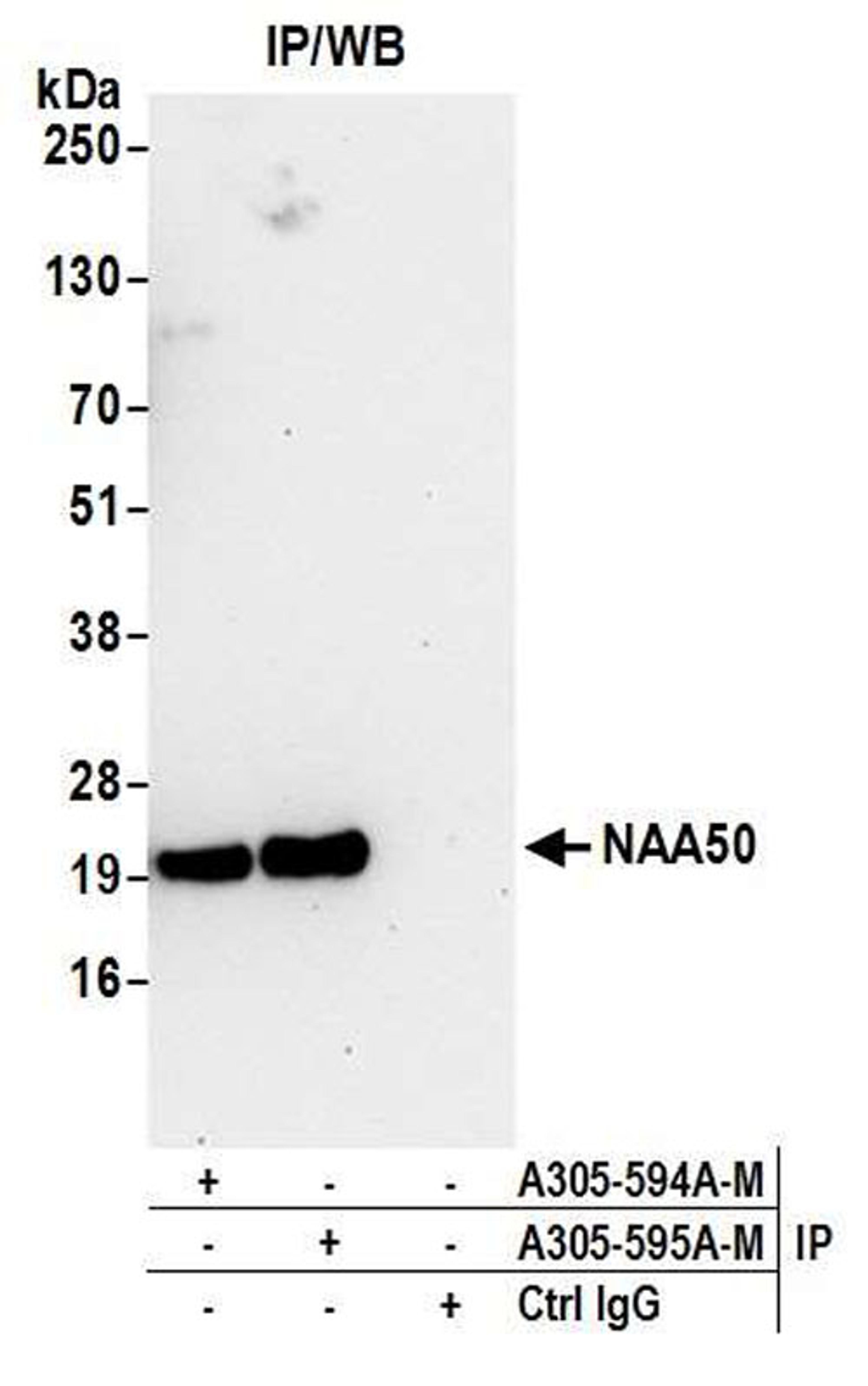 Detection of human NAA50 by WB of IP.