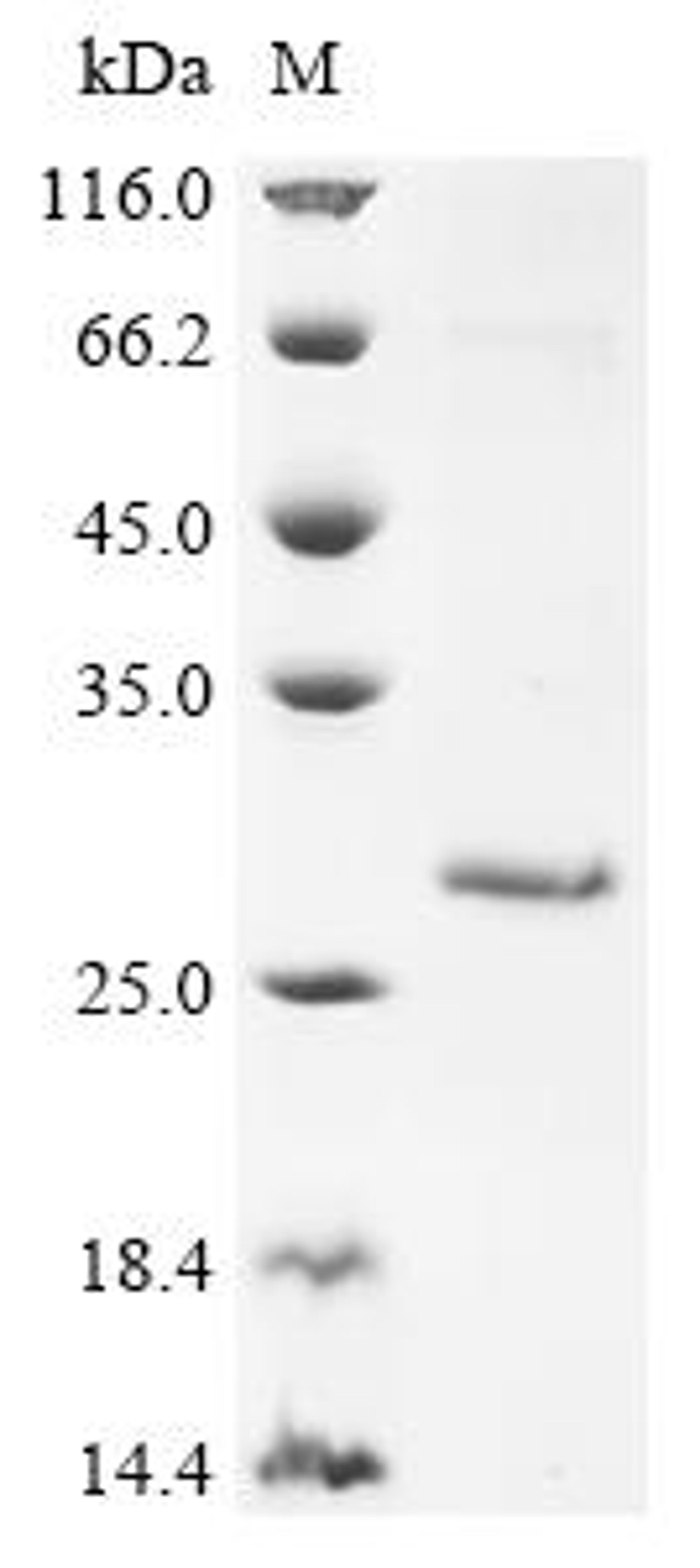 (Tris-Glycine gel) Discontinuous SDS-PAGE (reduced) with 5% enrichment gel and 15% separation gel.