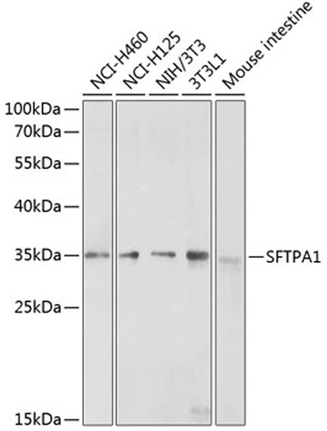 Western blot - SFTPA1 antibody (A3133)