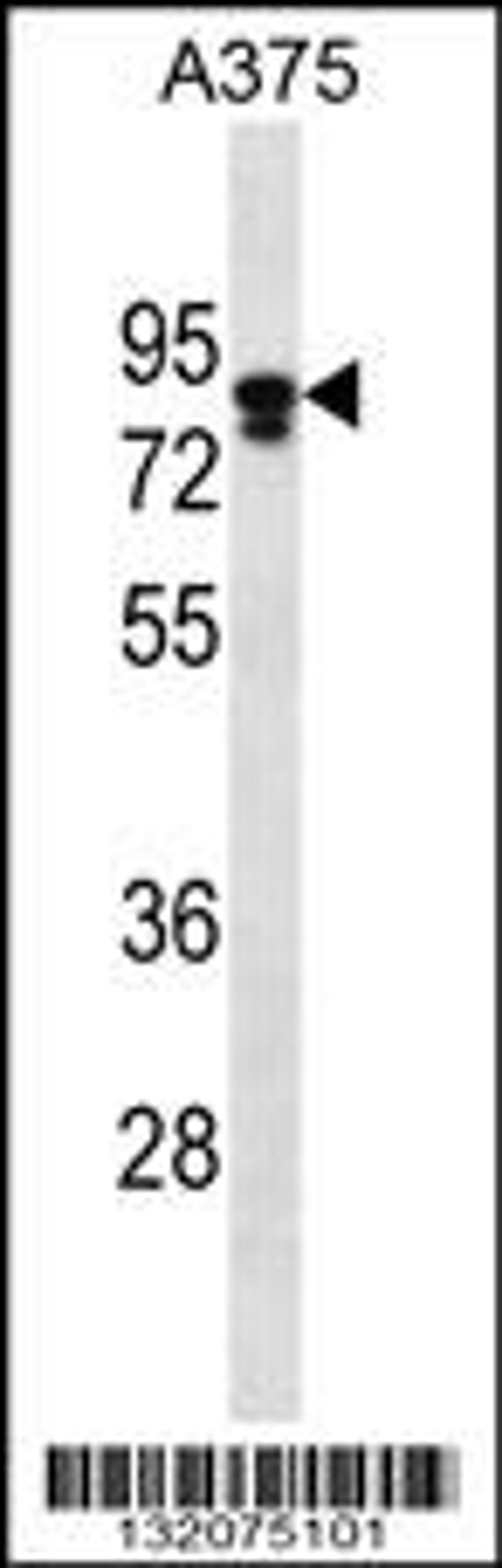 Western blot analysis in A375 cell line lysates (35ug/lane).