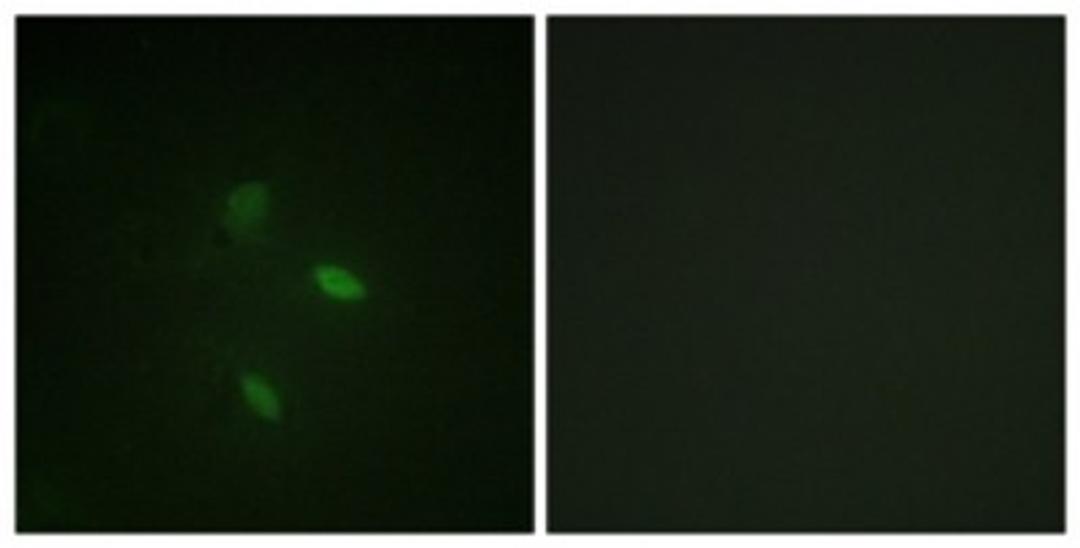 Immunocytochemistry/Immunofluorescence: Cyclin E2 Antibody [NBP1-61583] - Analysis of NIH-3T3 cells, using Cyclin E2  Antibody. The picture on the right is treated with the synthesized peptide.