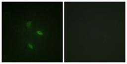 Immunocytochemistry/Immunofluorescence: Cyclin E2 Antibody [NBP1-61583] - Analysis of NIH-3T3 cells, using Cyclin E2  Antibody. The picture on the right is treated with the synthesized peptide.