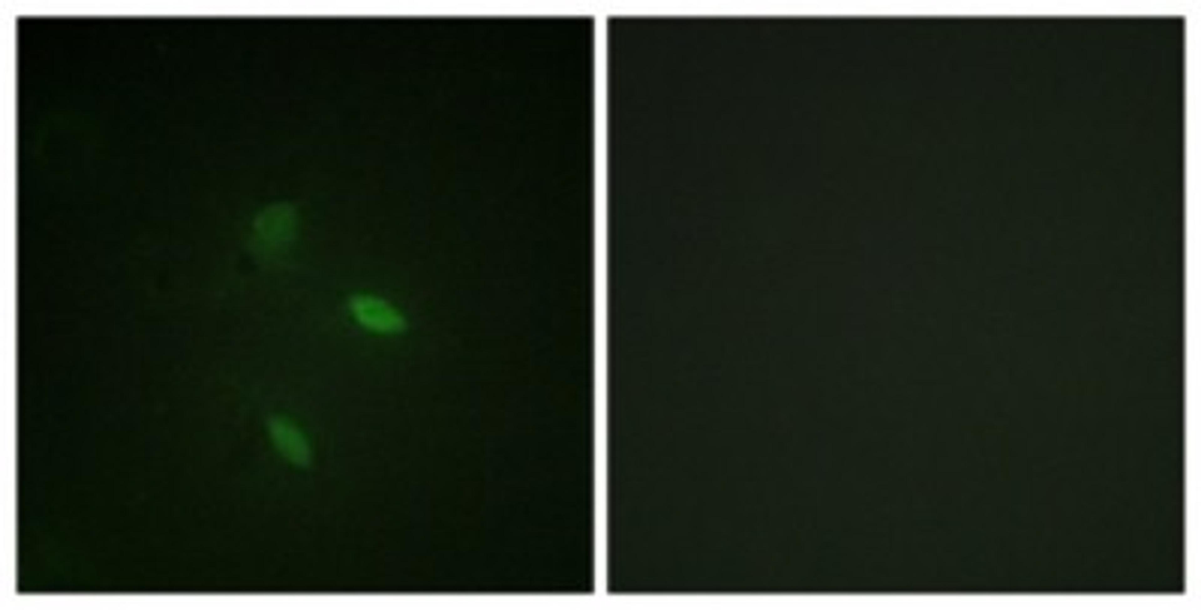 Immunocytochemistry/Immunofluorescence: Cyclin E2 Antibody [NBP1-61583] - Analysis of NIH-3T3 cells, using Cyclin E2  Antibody. The picture on the right is treated with the synthesized peptide.