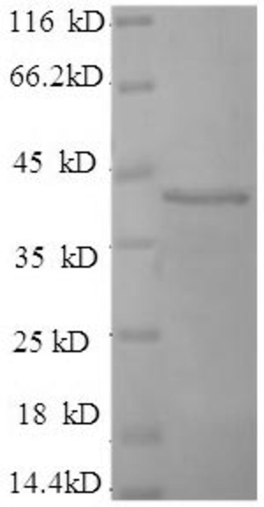 (Tris-Glycine gel) Discontinuous SDS-PAGE (reduced) with 5% enrichment gel and 15% separation gel.