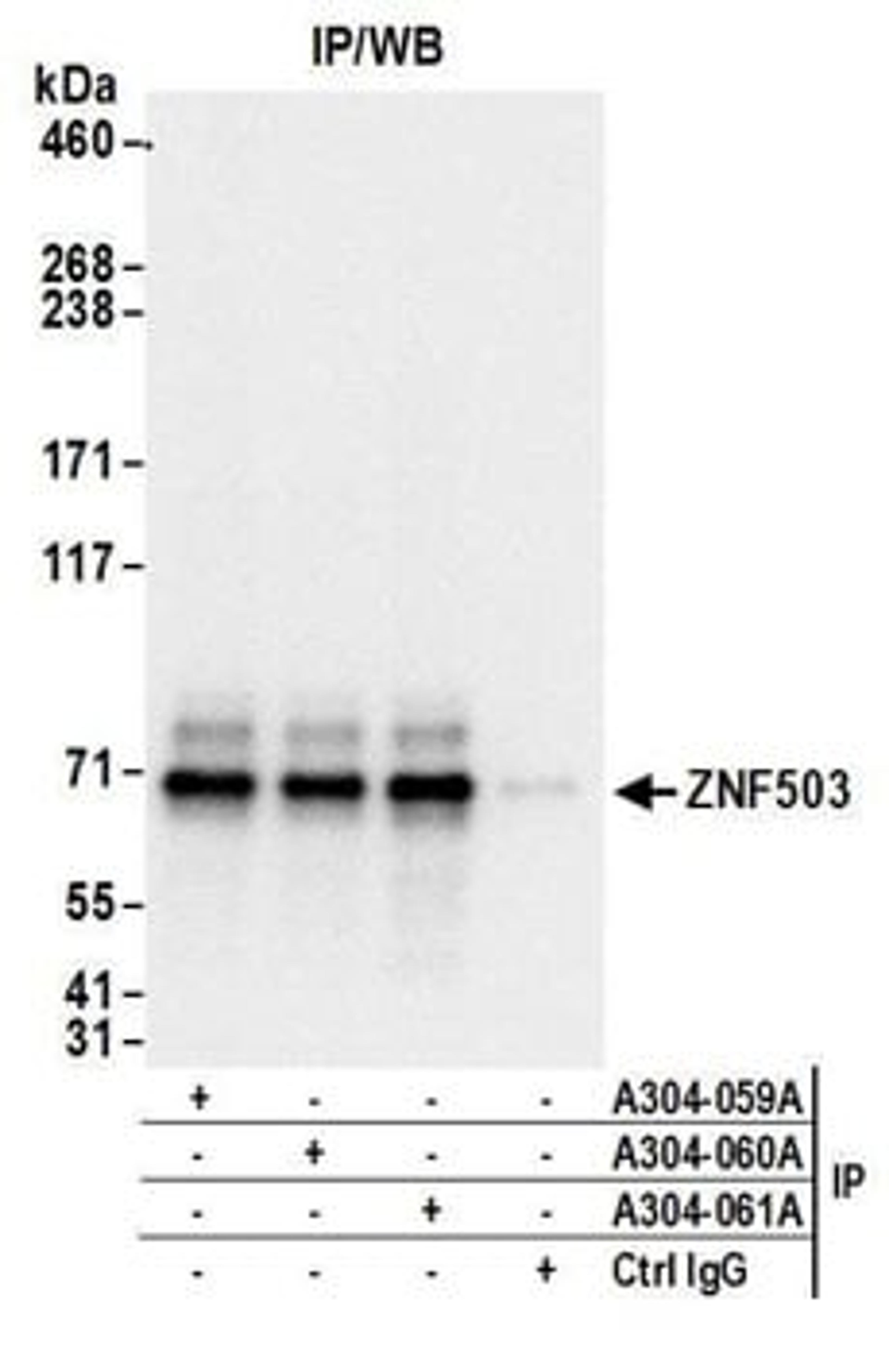 Detection of human ZNF503 by western blot of immunoprecipitates.