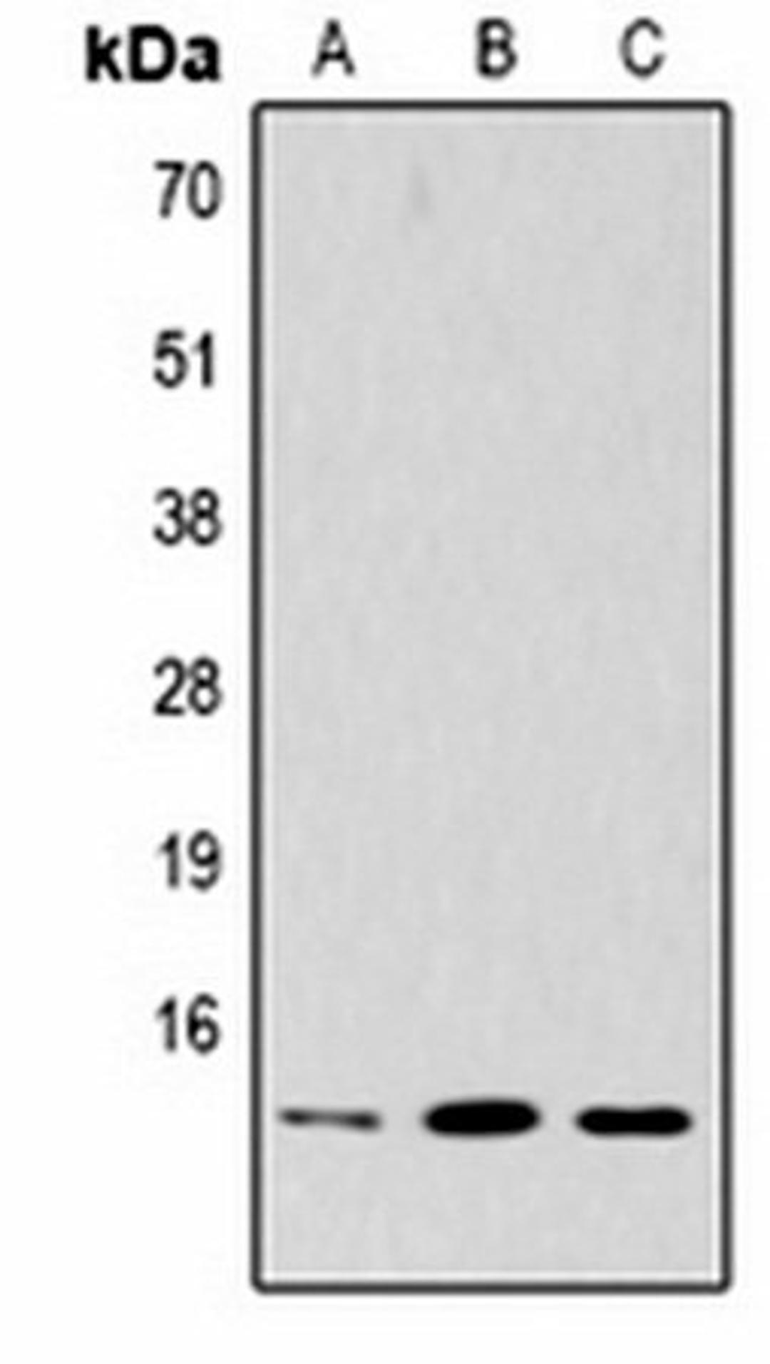 Western blot analysis of Hela (Lane1), rat brain (Lane2), NIH3T3 (Lane3) whole cell lysates using Histone H2B (TriMethyl K5) antibody