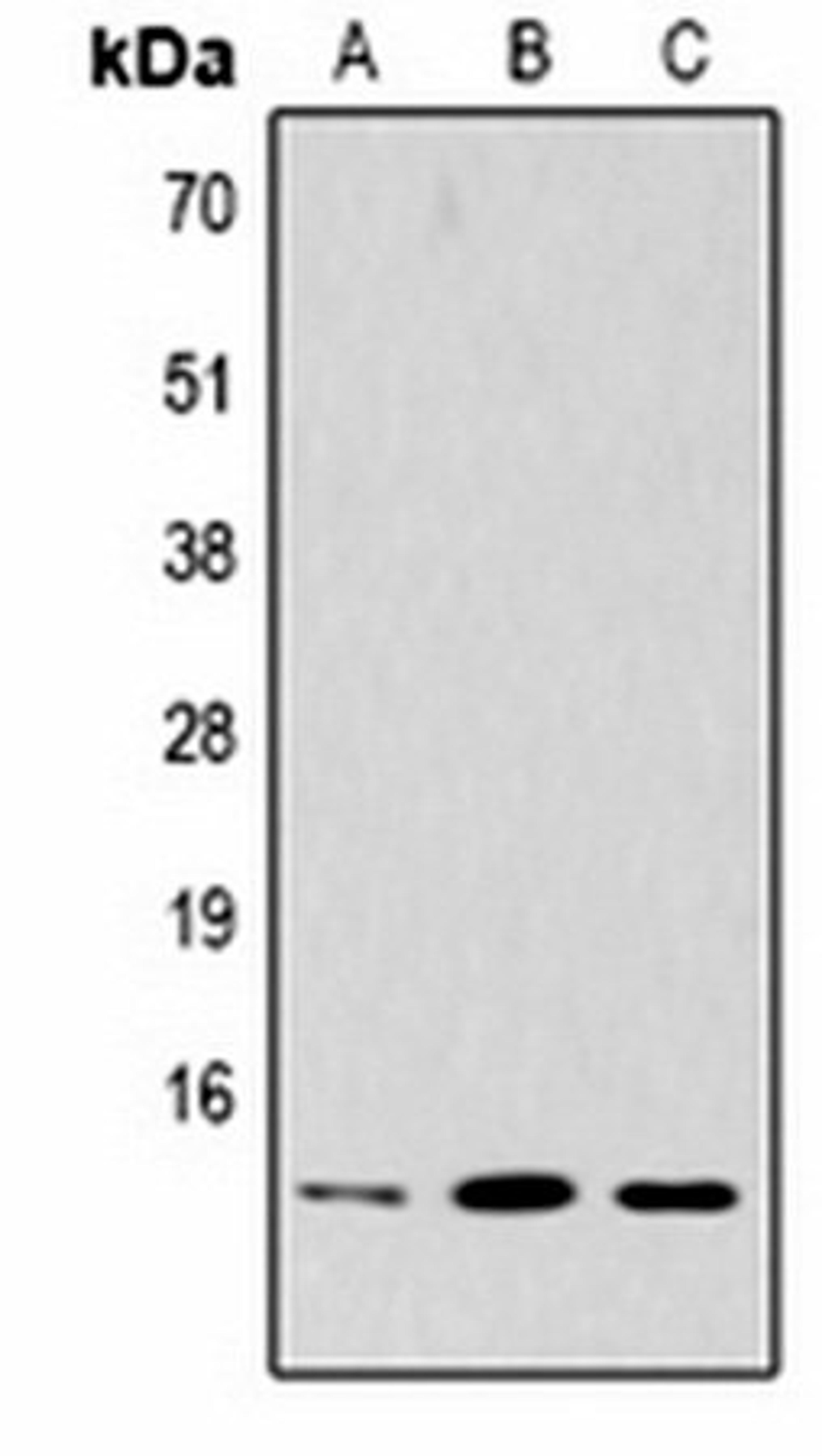Western blot analysis of Hela (Lane1), rat brain (Lane2), NIH3T3 (Lane3) whole cell lysates using Histone H2B (TriMethyl K5) antibody