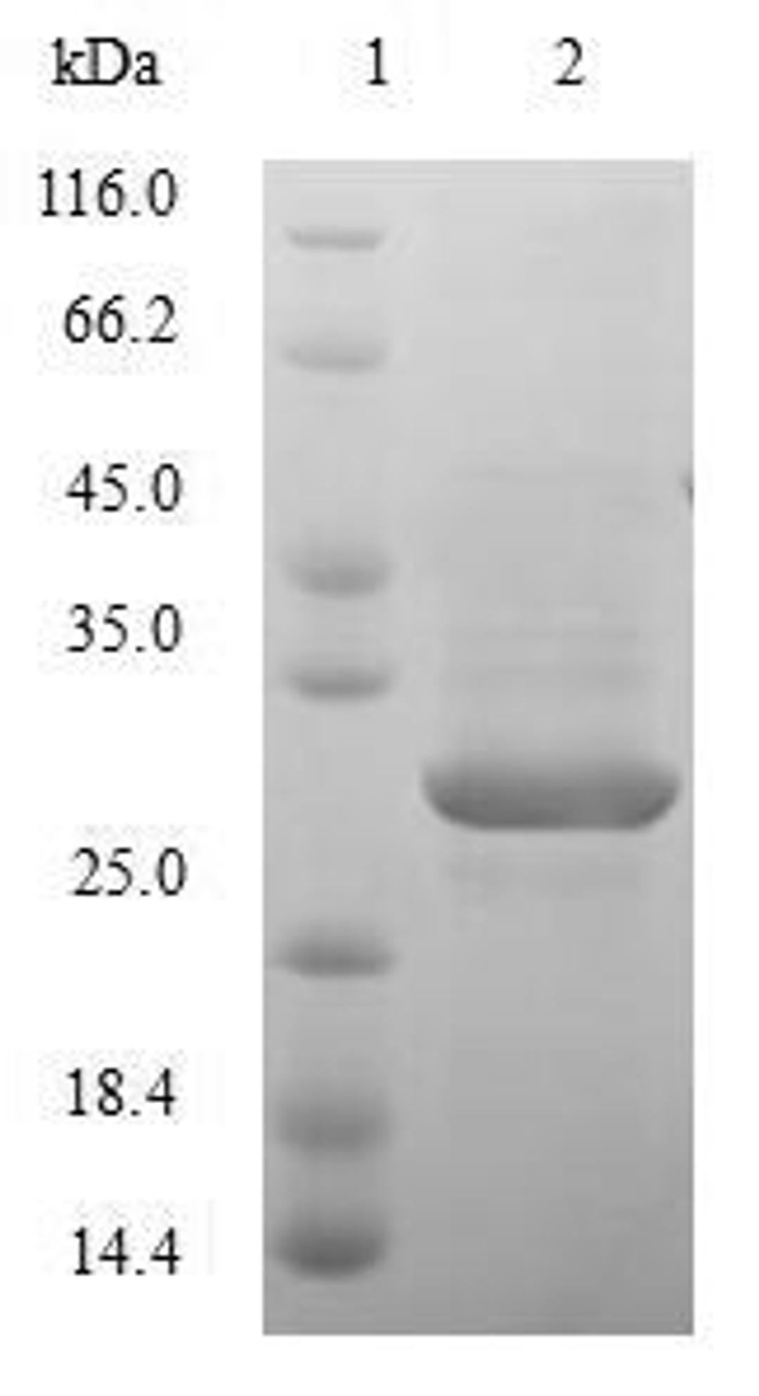 (Tris-Glycine gel) Discontinuous SDS-PAGE (reduced) with 5% enrichment gel and 15% separation gel.
