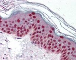 Immunohistochemistry staining of CDK9 in skin tissue using CDK9 Antibody.