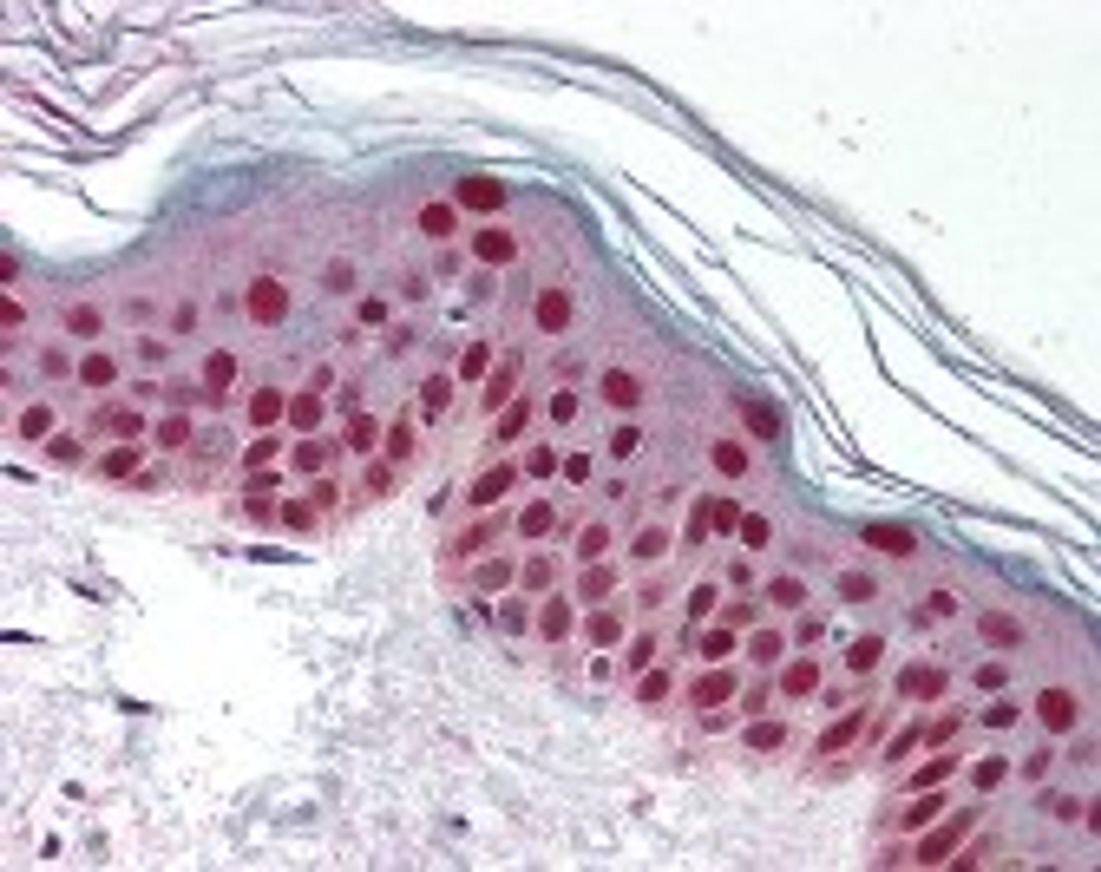 Immunohistochemistry staining of CDK9 in skin tissue using CDK9 Antibody.