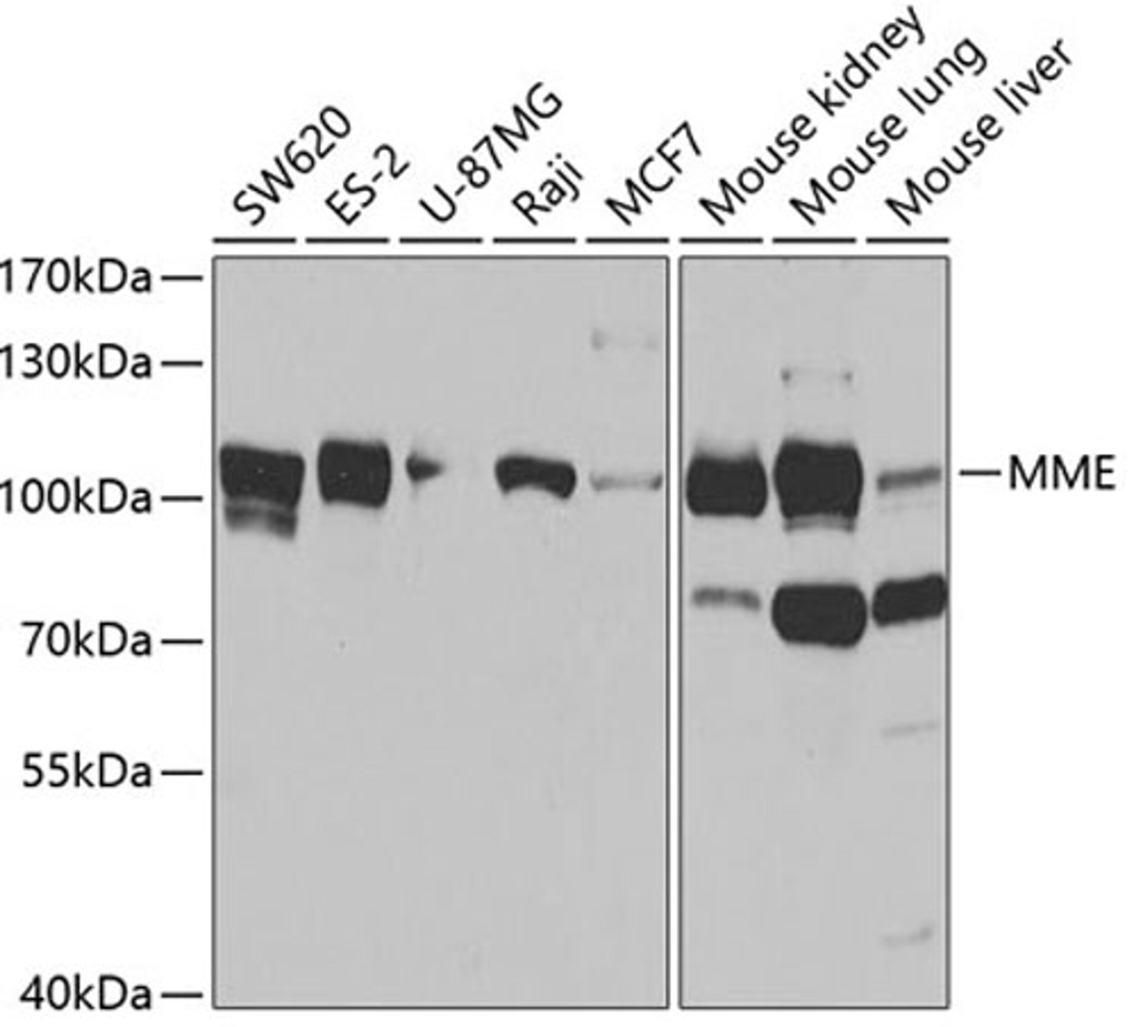 Western blot - MME antibody (A5664)