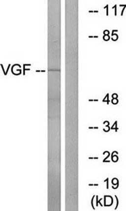 Western blot analysis of extracts from RAW264.7 cells using VGF antibody