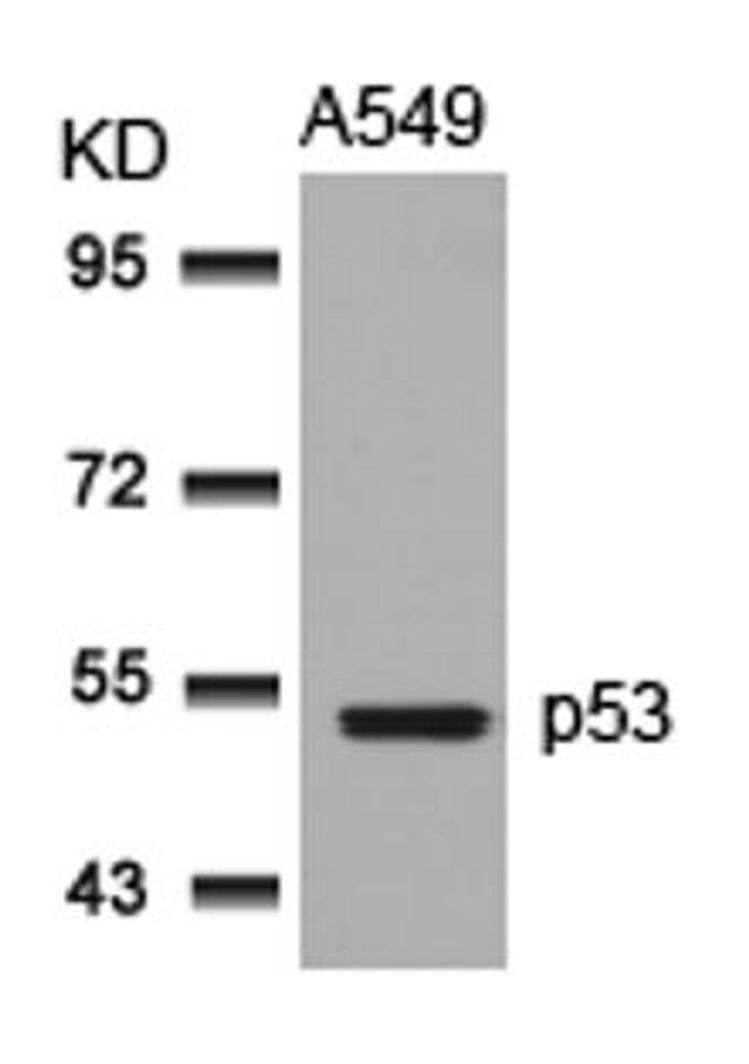 Western blot analysis of lysed extracts from A549 cells using p53 (Ab-315).