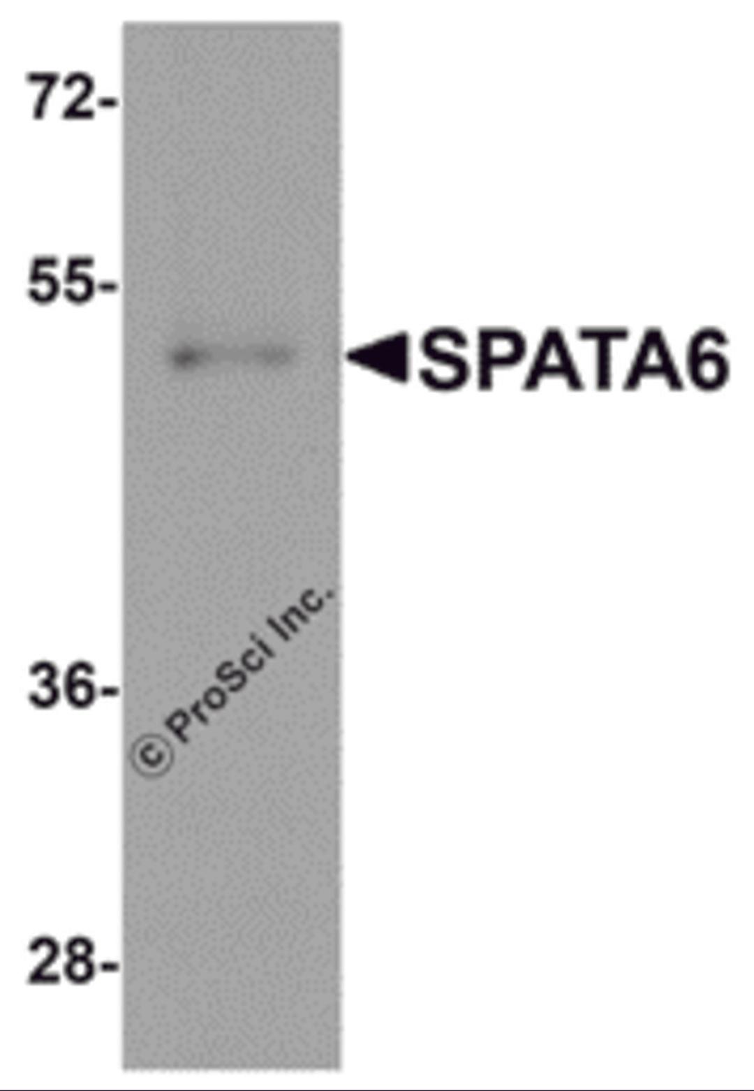 Western blot analysis of SPATA6 in A20 cell lysate with SPATA6 antibody at 1 μg/mL.