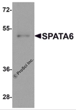 Western blot analysis of SPATA6 in A20 cell lysate with SPATA6 antibody at 1 μg/mL.