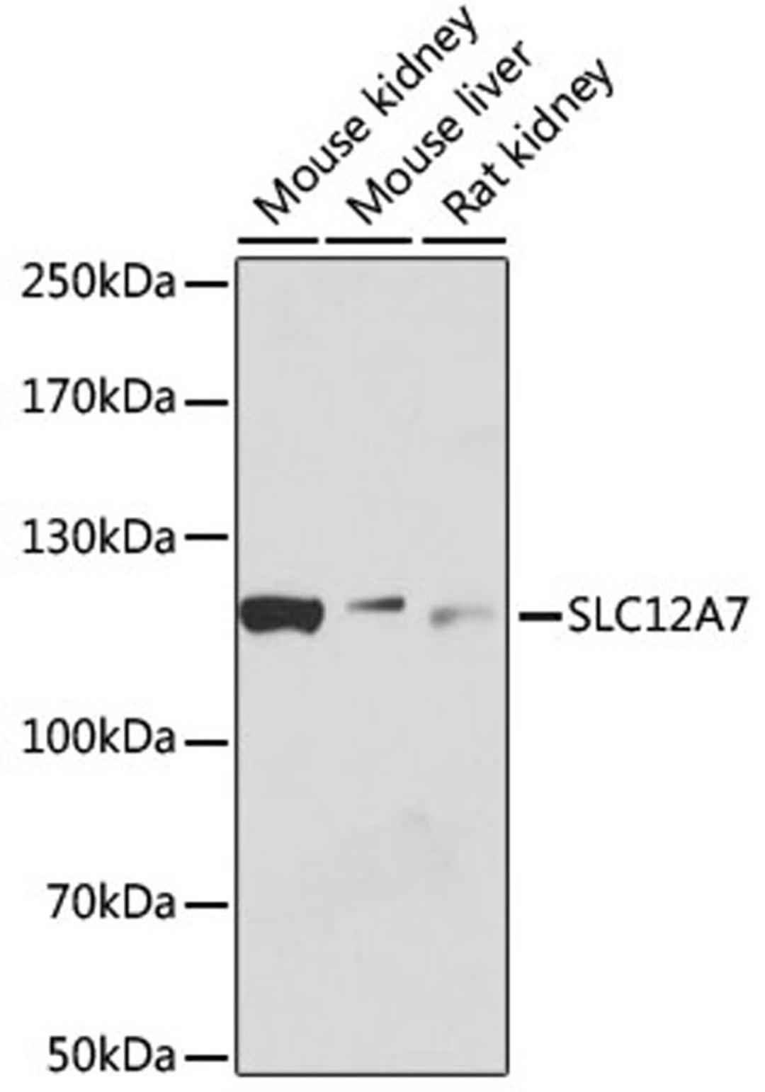 Western blot - SLC12A7 antibody (A12299)