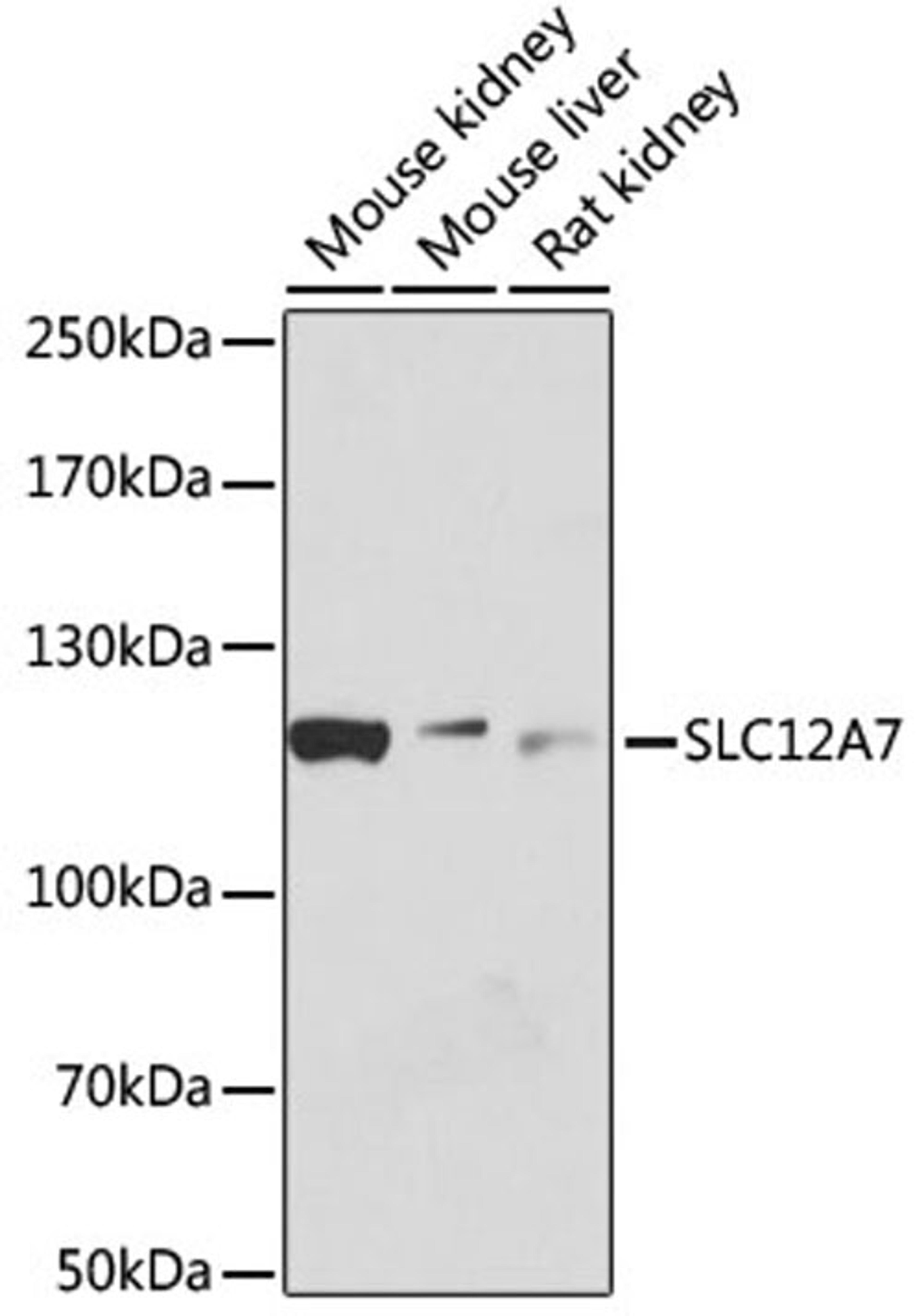 Western blot - SLC12A7 antibody (A12299)