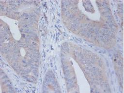 Immunohistochemistry of paraffin-embedded human placenta tissue using CSB-PA06615A0Rb at dilution of 1:100