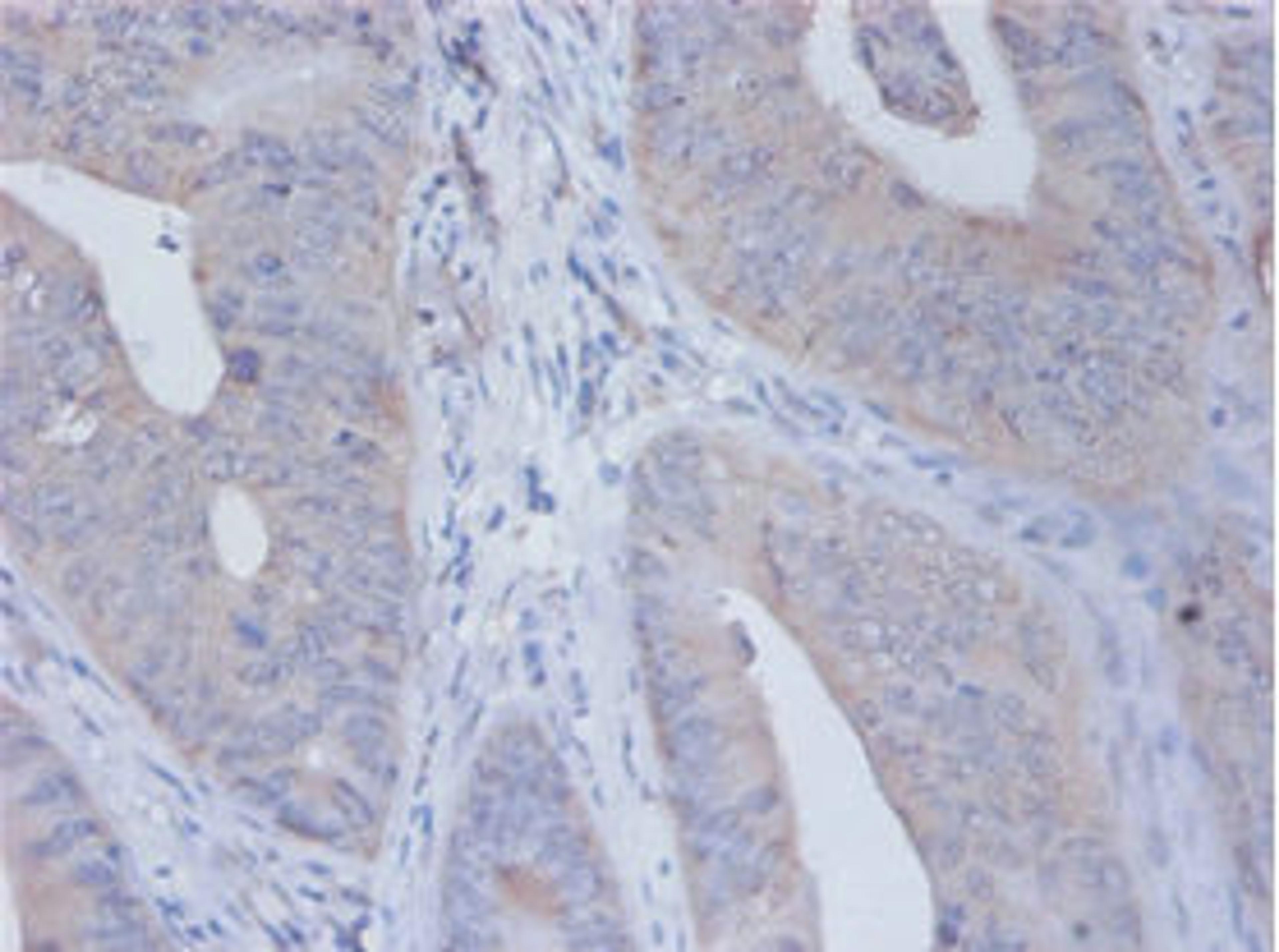 Immunohistochemistry of paraffin-embedded human placenta tissue using CSB-PA06615A0Rb at dilution of 1:100