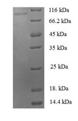 (Tris-Glycine gel) Discontinuous SDS-PAGE (reduced) with 5% enrichment gel and 15% separation gel.