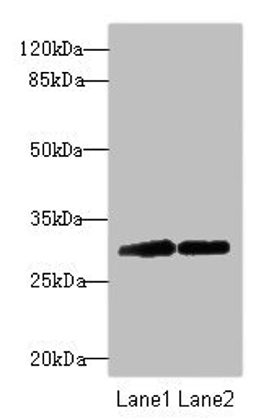 Western blot. All lanes: TRIM69 antibody at 2.24ug/ml. Lane 1: Mouse kidney tissue. Lane 2: Mouse brain tissue. Secondary. Goat polyclonal to rabbit IgG at 1/10000 dilution. Predicted band size: 58, 40, 35, 33 kDa. Observed band size: 58, 32 kDa. 