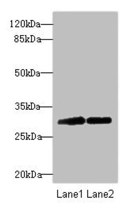 Western blot. All lanes: TRIM69 antibody at 2.24ug/ml. Lane 1: Mouse kidney tissue. Lane 2: Mouse brain tissue. Secondary. Goat polyclonal to rabbit IgG at 1/10000 dilution. Predicted band size: 58, 40, 35, 33 kDa. Observed band size: 58, 32 kDa. 