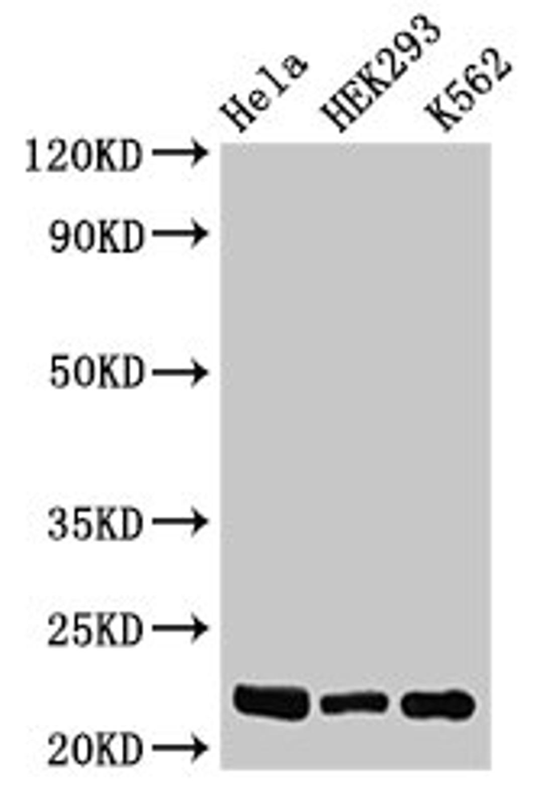 Western Blot. Positive WB detected in: Hela whole cell lysate, HEK293 whole cell lysate, K562 whole cell lysate. All lanes: HIST1H1E antibody at 0.5µg/ml. Secondary. Goat polyclonal to rabbit IgG at 1/50000 dilution. Predicted band size: 22 kDa. Observed band size: 22 kDa