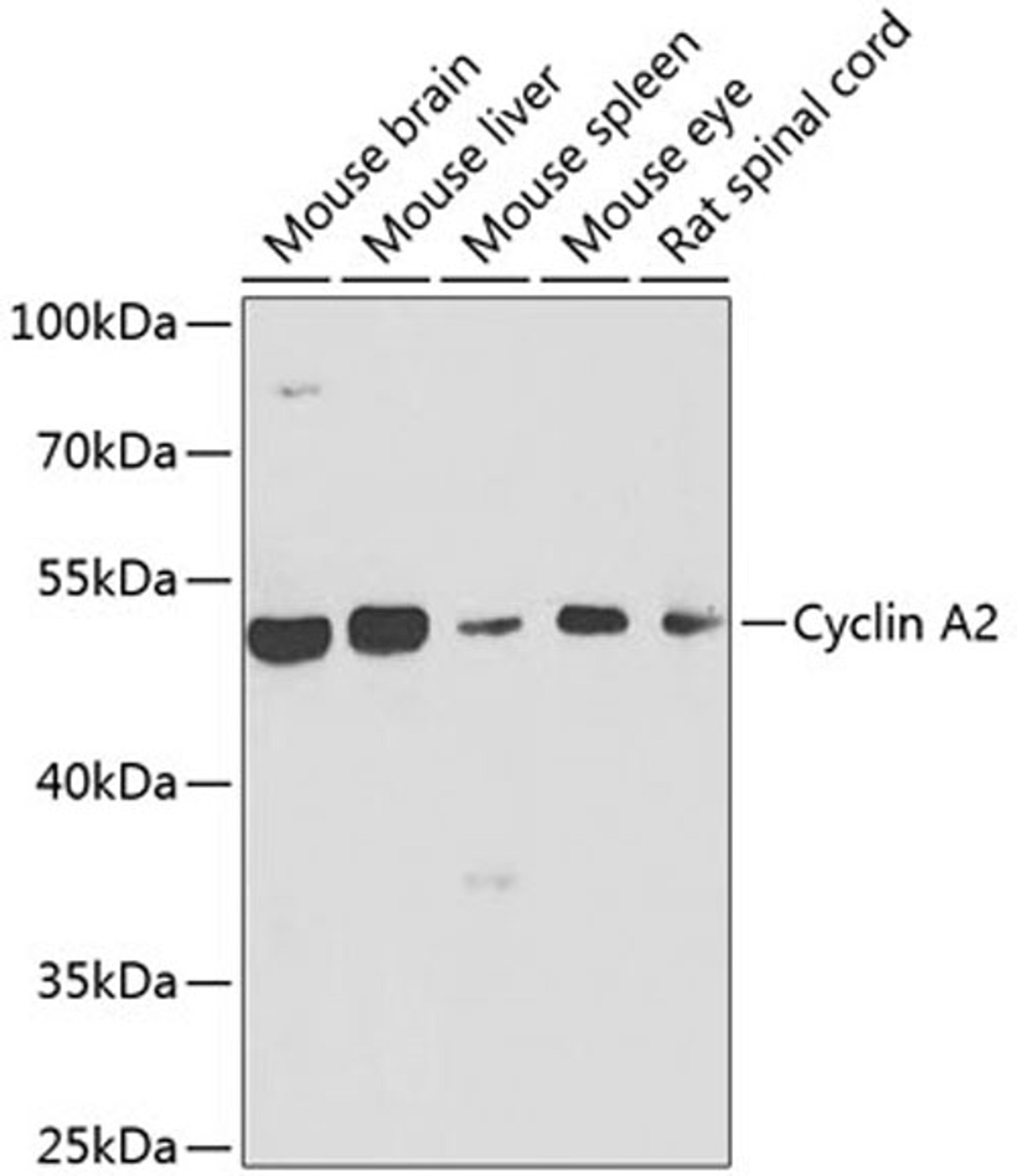 Western blot - Cyclin A2 antibody (A7632)