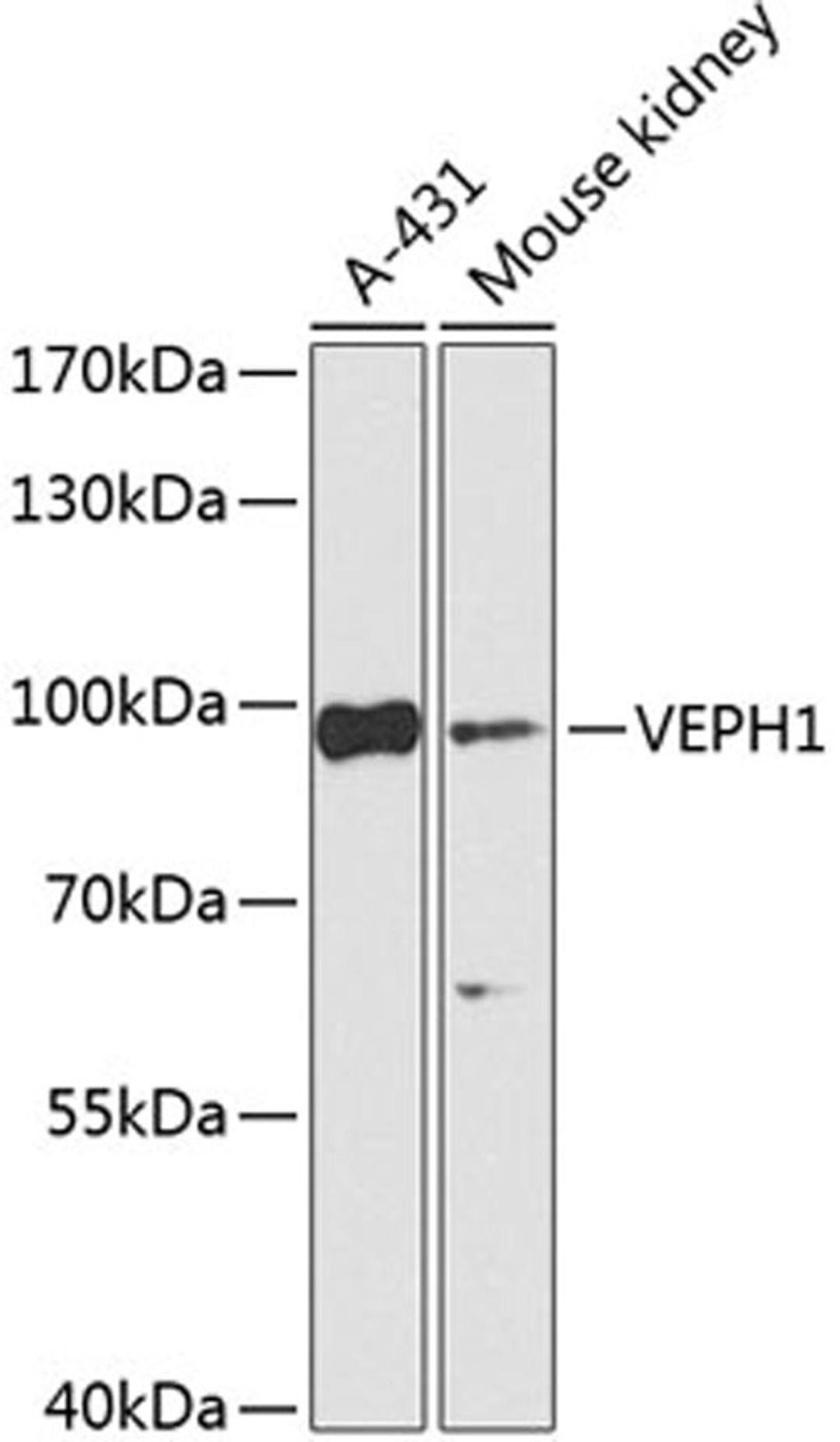 Western blot - VEPH1 Antibody (A15228)