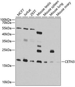 Western blot - CETN3 antibody (A8111)