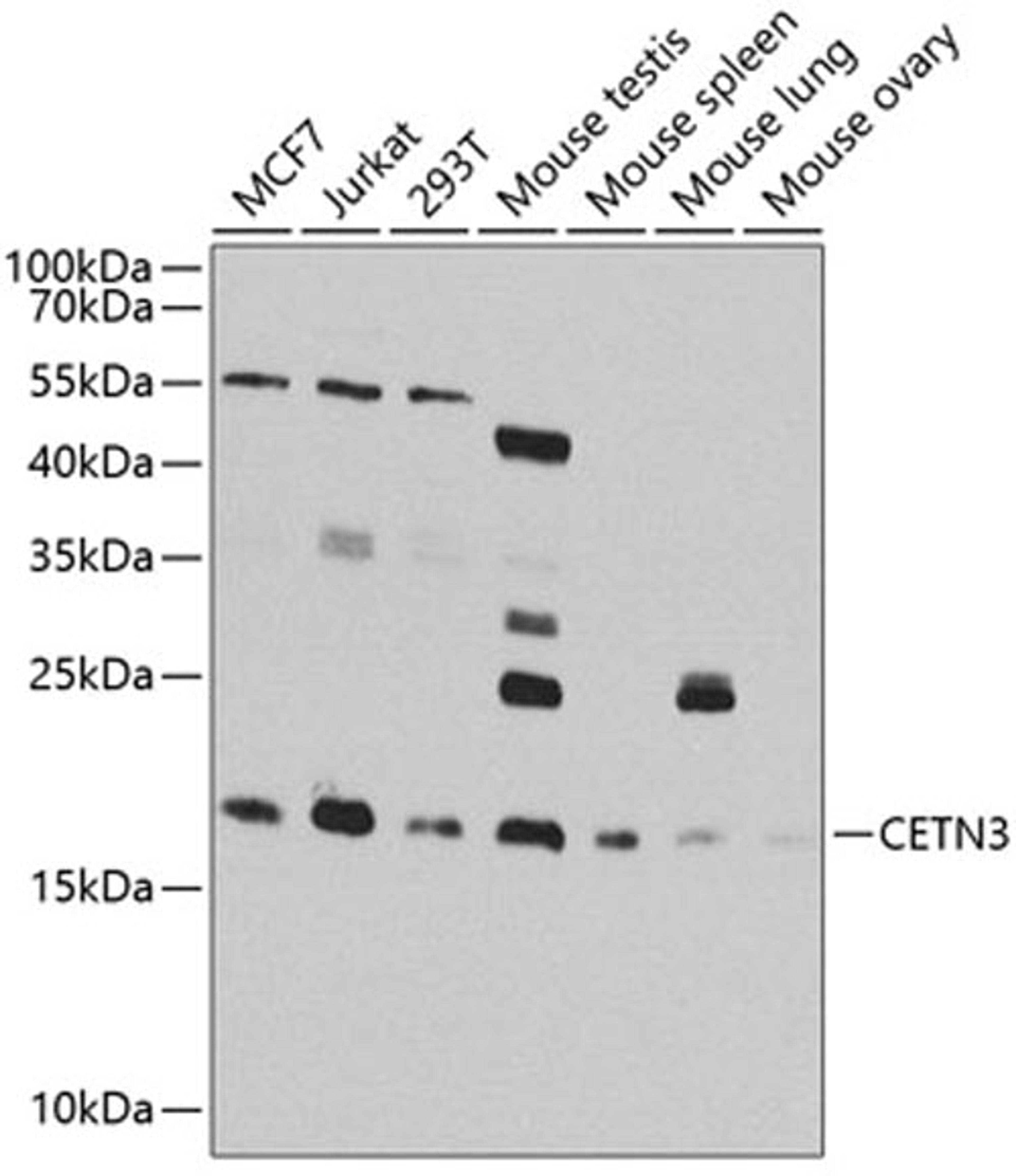 Western blot - CETN3 antibody (A8111)