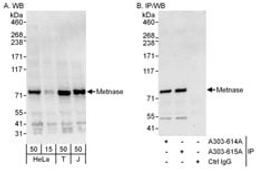 Detection of human Metnase by western blot and immunoprecipitation.