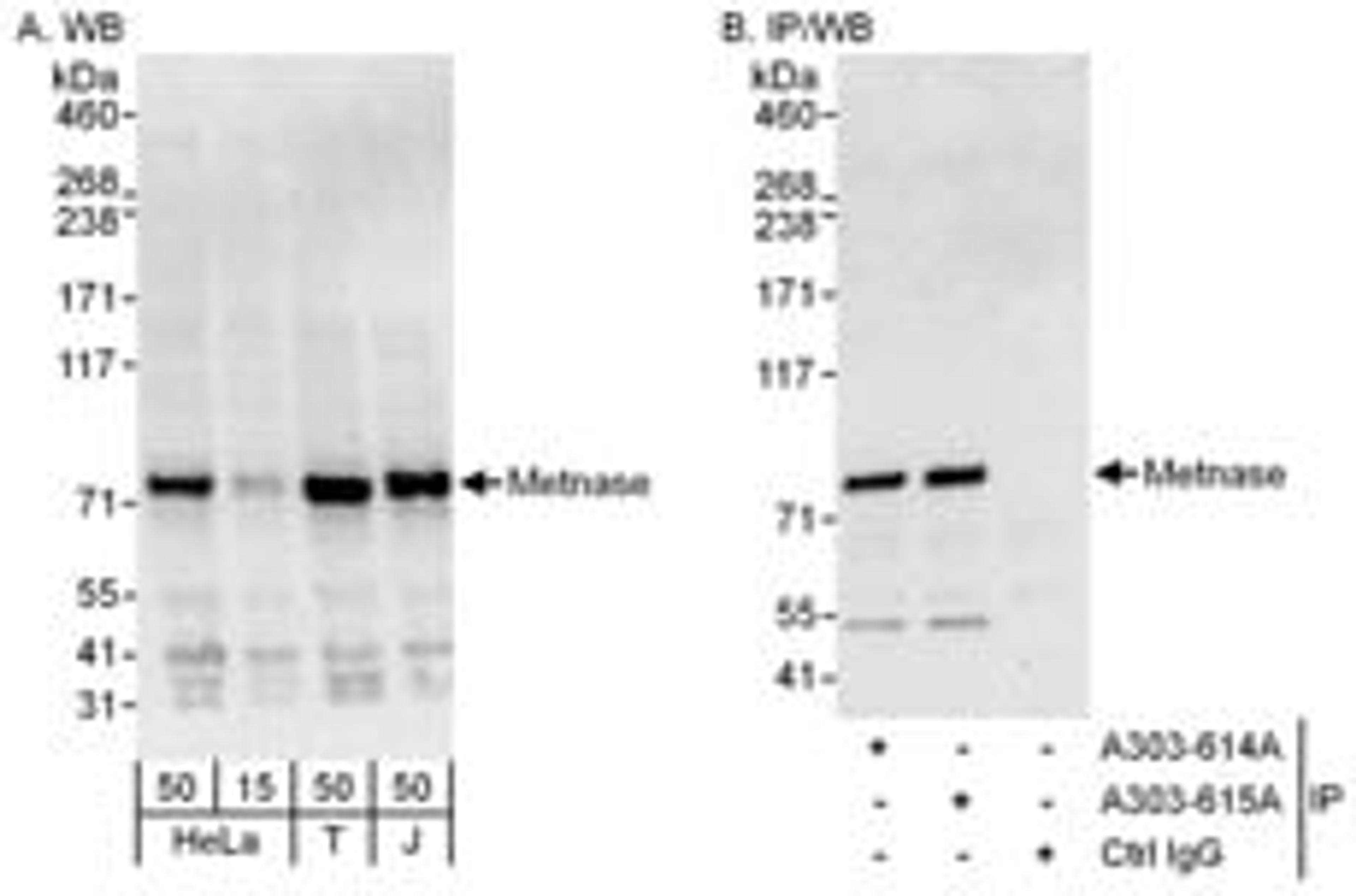 Detection of human Metnase by western blot and immunoprecipitation.