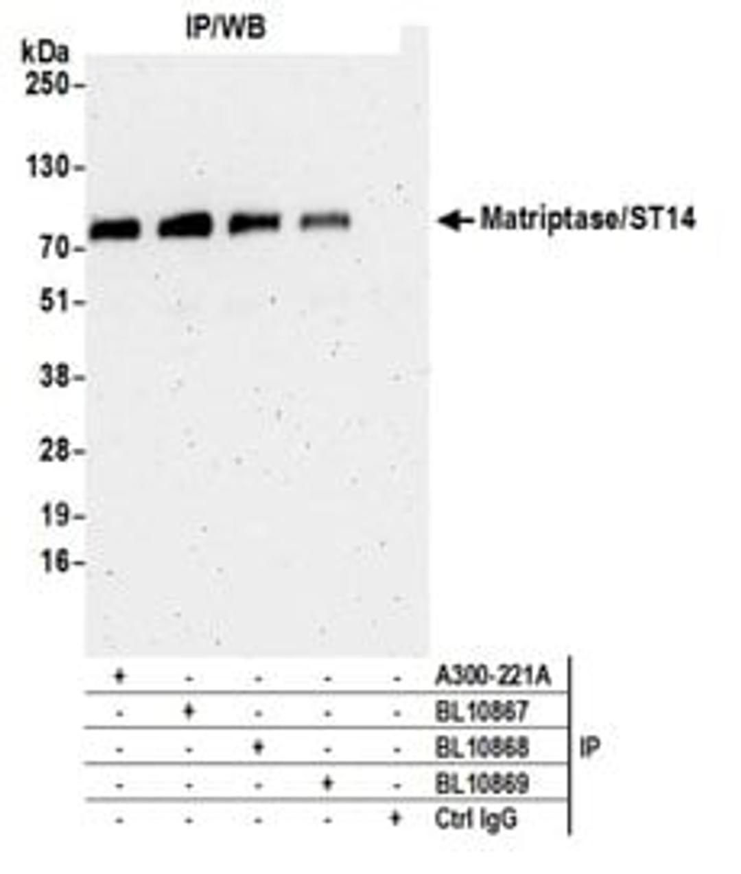 Detection of human Matriptase/ST14 by western blot of immunoprecipitates.