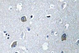 Immunohistochemistry-Paraffin: GNAL Antibody [NBP1-00840] - Immunohistochemistry (IHC) analyzes of Ga olf (D81) antibody in paraffin-embedded human brain tissue