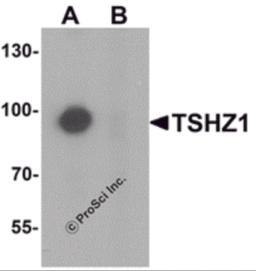 Western blot analysis of TSHZ1 in A-20 cell lysate with TSHZ1 antibody at 1 &#956;g/mL in (A) the absence and (B) the presence of blocking peptide.