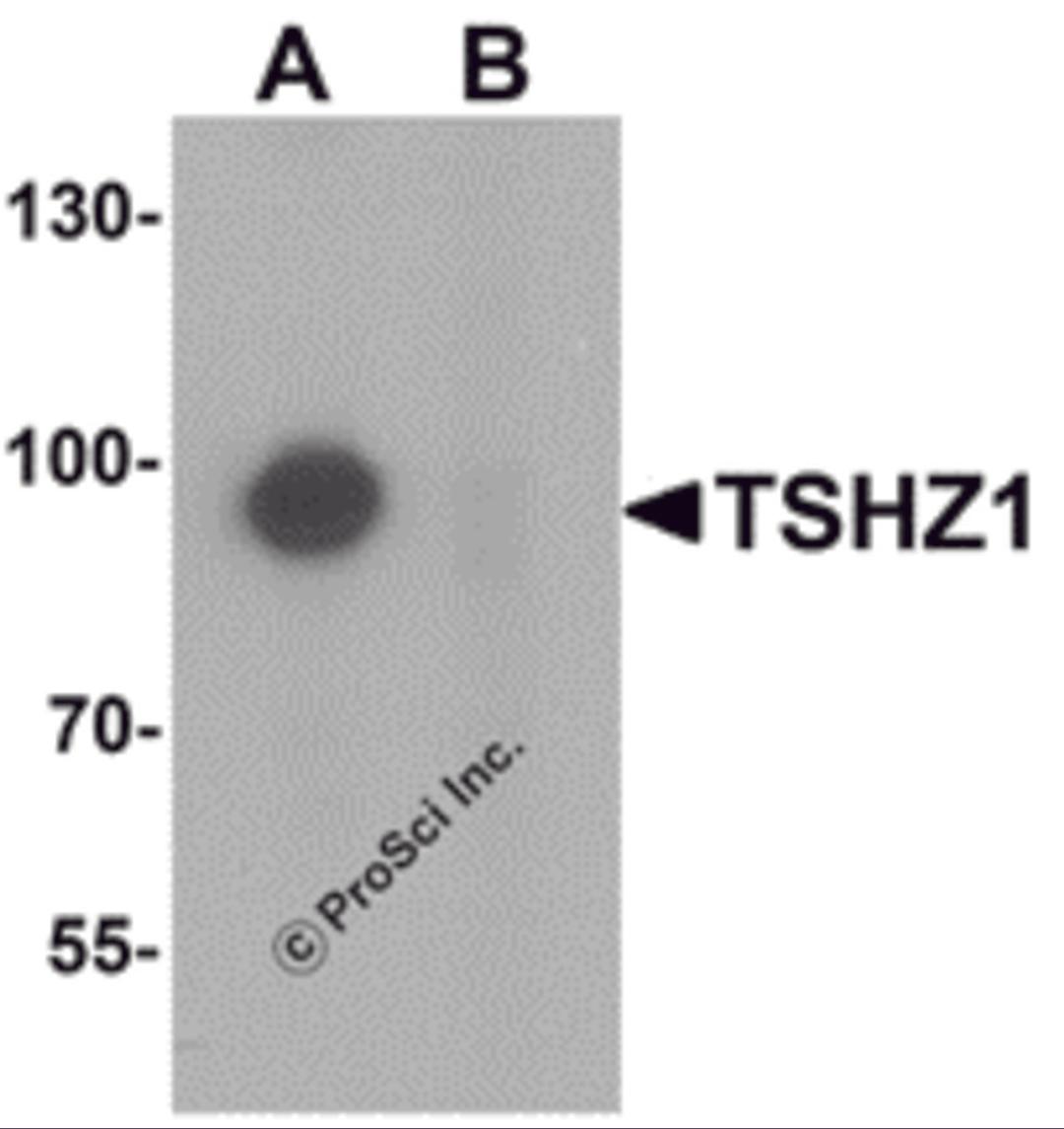Western blot analysis of TSHZ1 in A-20 cell lysate with TSHZ1 antibody at 1 μg/mL in (A) the absence and (B) the presence of blocking peptide.