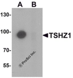 Western blot analysis of TSHZ1 in A-20 cell lysate with TSHZ1 antibody at 1 μg/mL in (A) the absence and (B) the presence of blocking peptide.