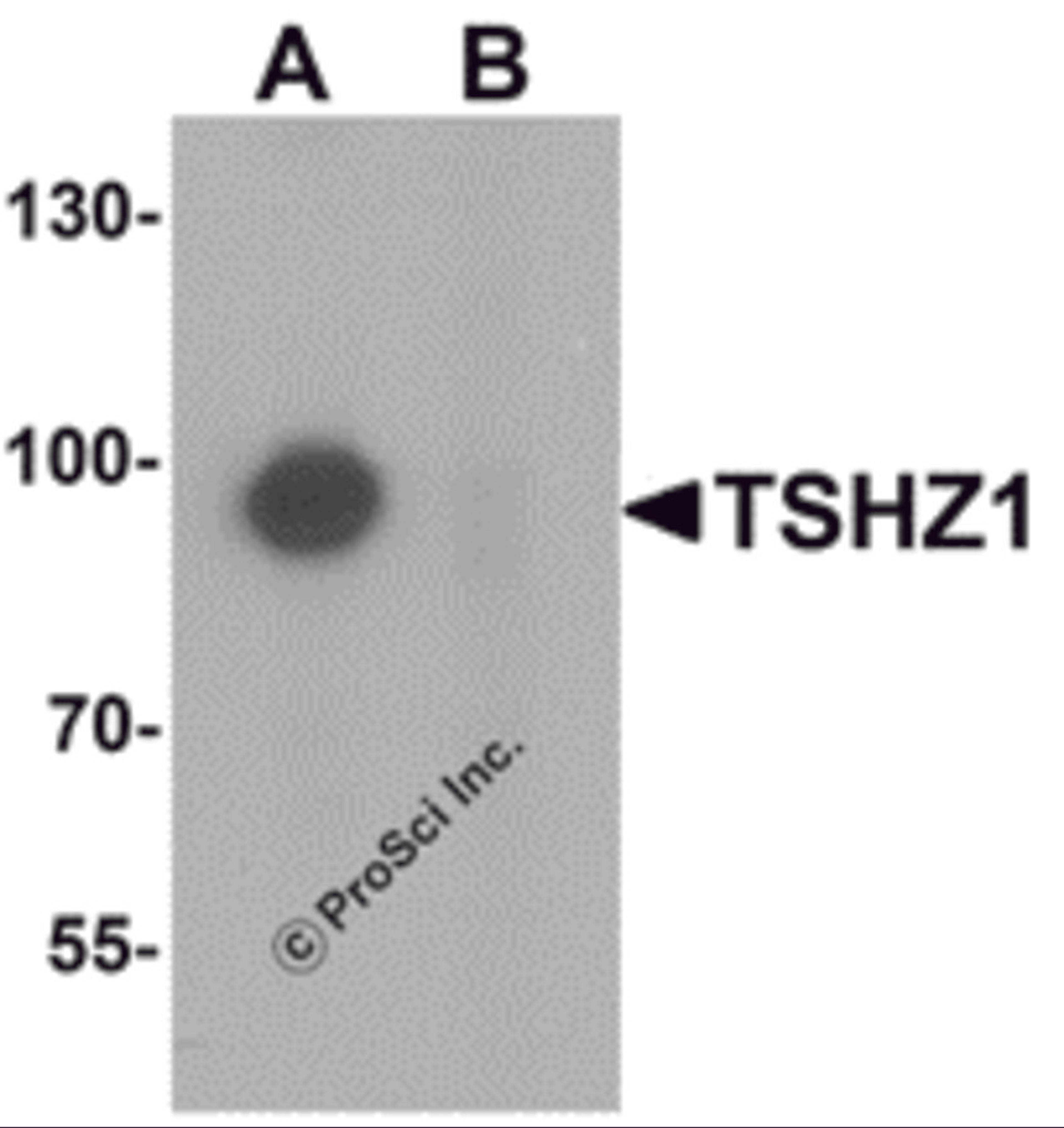 Western blot analysis of TSHZ1 in A-20 cell lysate with TSHZ1 antibody at 1 μg/mL in (A) the absence and (B) the presence of blocking peptide.